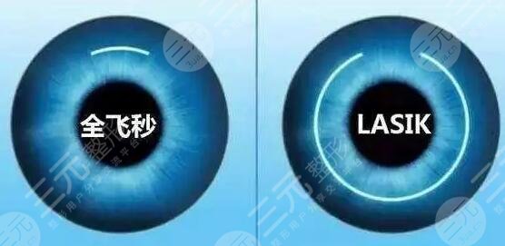 近视眼激光手术之后会瞎吗?