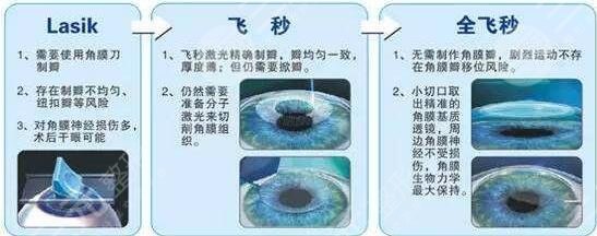 屈光矫正手术有要求吗?