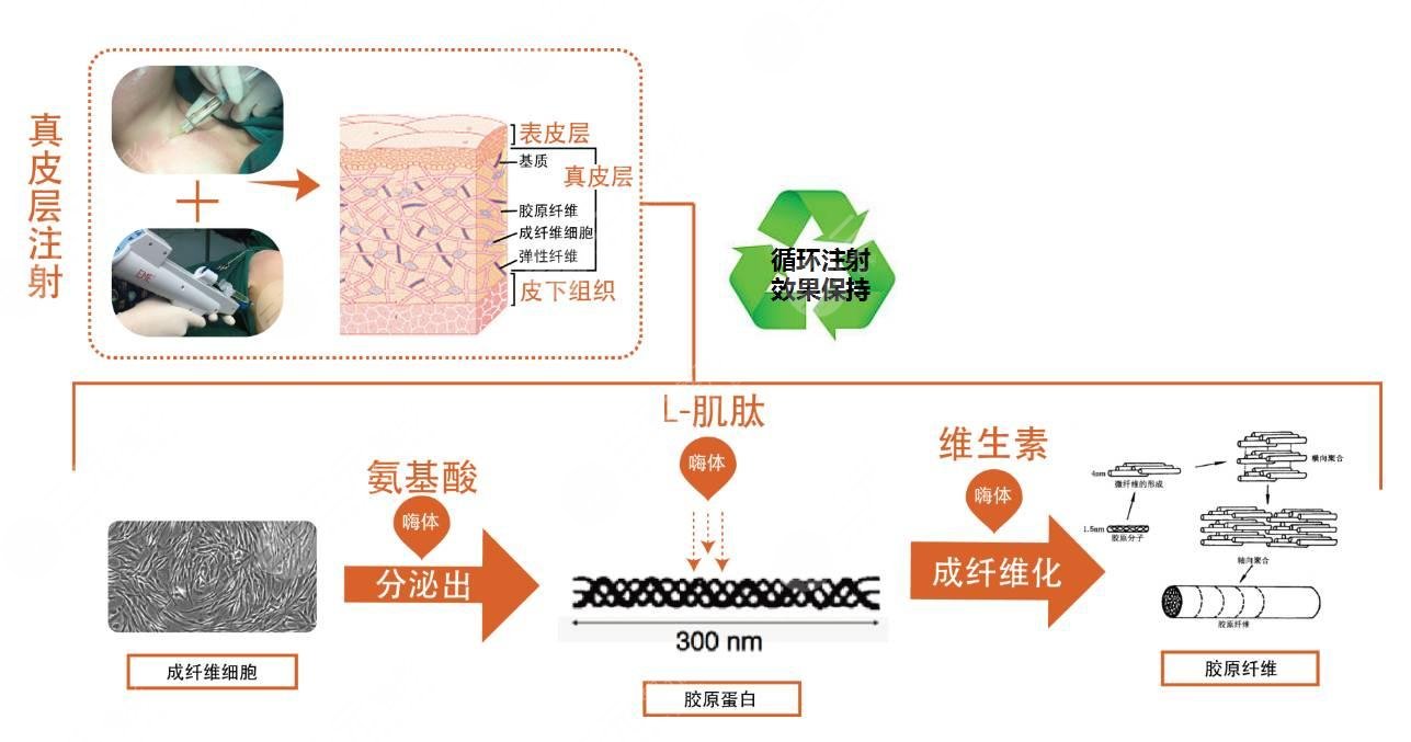 北京画美开展项目科普：嗨体除皱