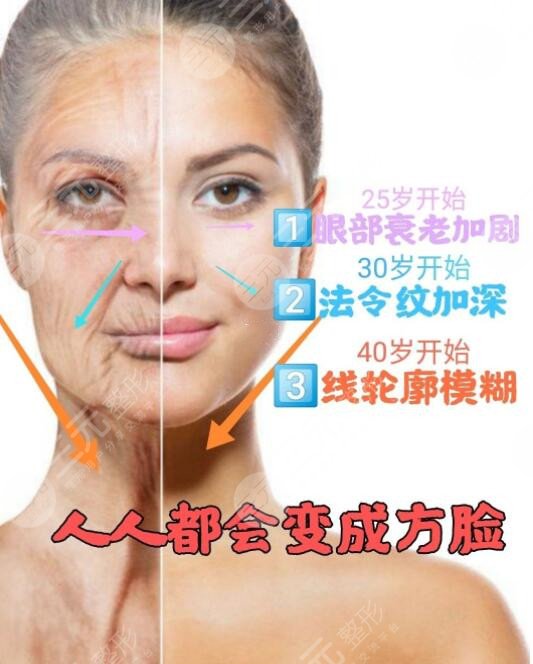 上海九院整形科拉皮除皱项目科普：