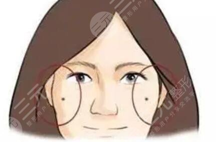 吉大二院美容皮肤科姚春丽祛痣案例，附价格表