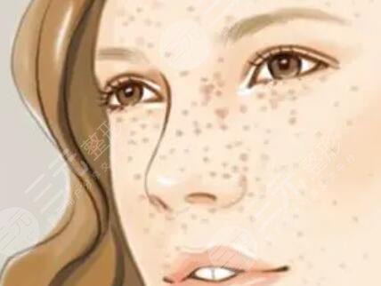 安医一附院有激光美容科怎样?价格表+祛斑案例