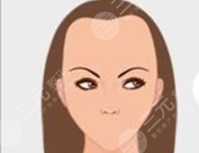 华山医院植发专科可以用医保吗