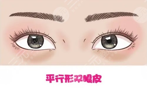 双眼皮整形