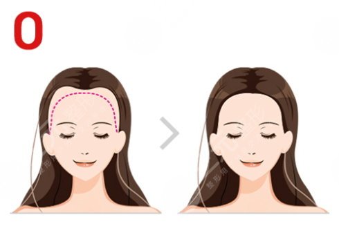 植发技术没问题吗