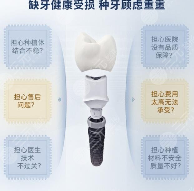 牙齿种植基台需要多久才能装牙?
