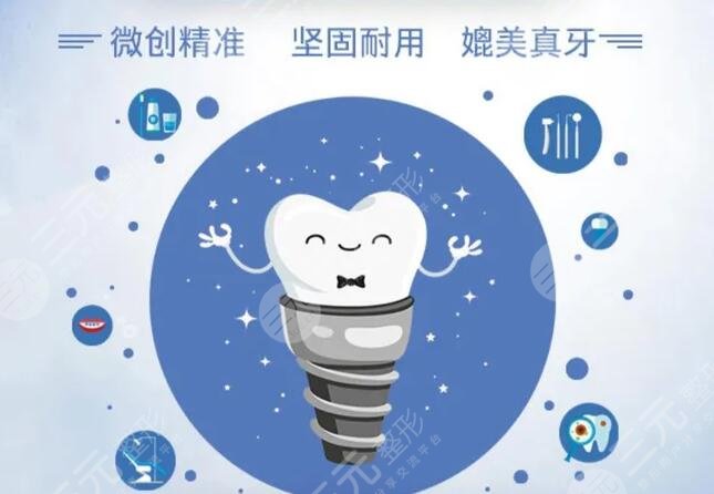牙齿种植
