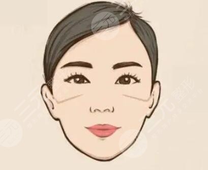 诸暨人民医院美容整形科怎么样