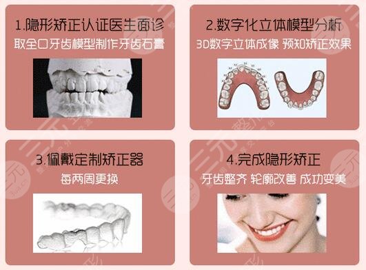 上海美奥口腔门诊部科普隐形正畸