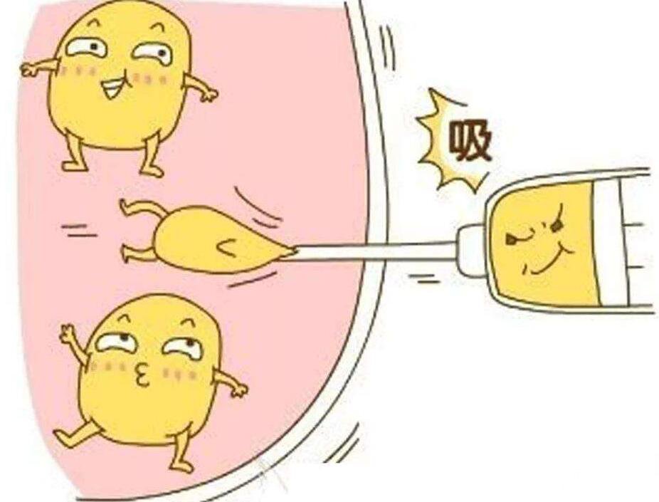 吸脂瘦后背
