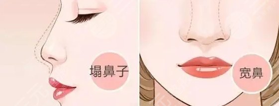 桃太郎 中国医学科学院美容整形医院