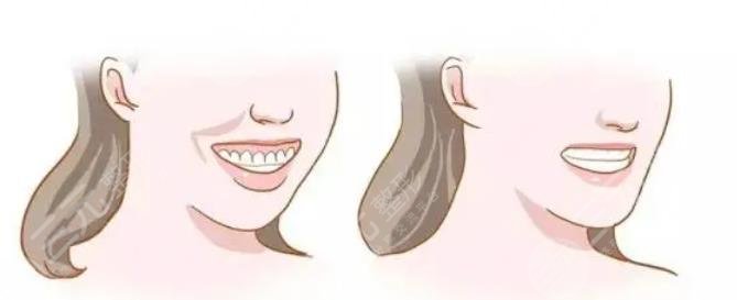 上海美奥口腔医院科普知识