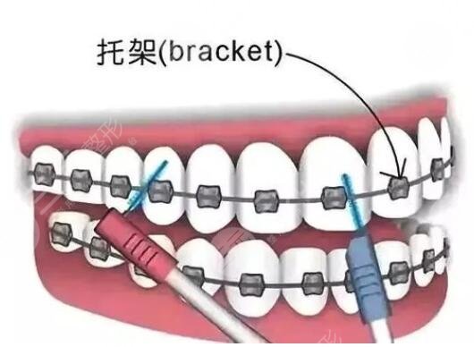 美奥口腔医院科普