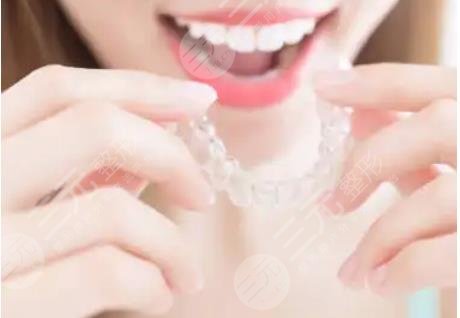 龙岗中心医院牙齿矫正案例参考