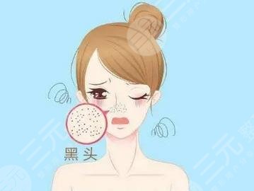 激光祛斑案例