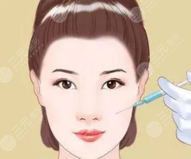 瘦脸案例