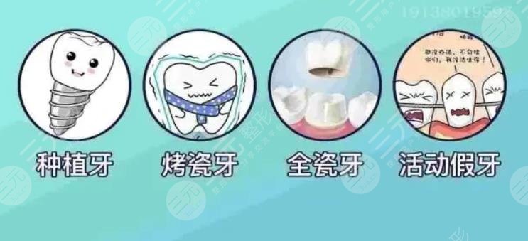 牙齿种植案例