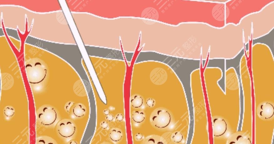 昆明医科大学第二附属医院整形科擅长项目