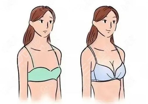 上海九院隆胸手术