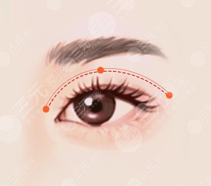 广州曙光整形美容医院案例