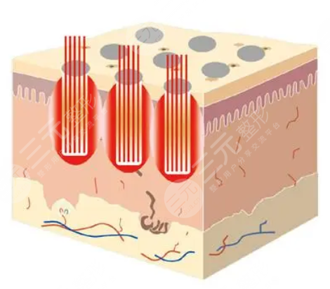 广州曙光医院热门项目