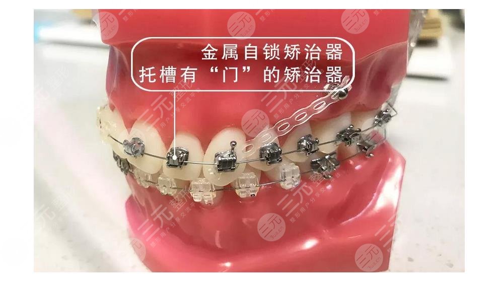 中山医院口腔科怎么样呢?