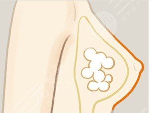 浙江大学医学院附属第二医院整形科怎么样?