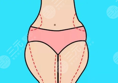 四川米兰柏羽口碑怎么样?