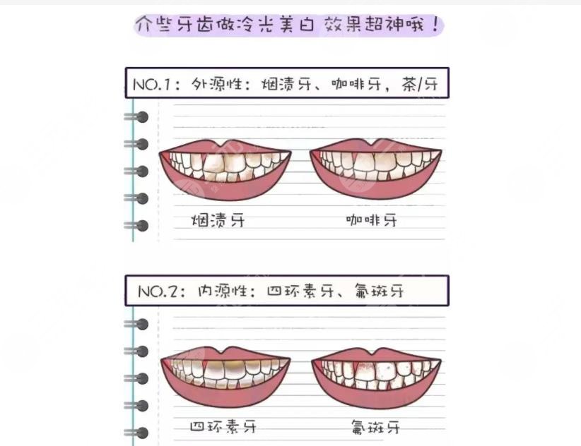 广州柏德口腔医院热门项目