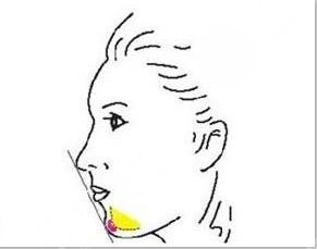 广州海峡整形医院热门项目