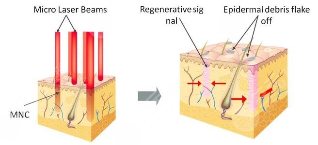深圳北大医院?激光美容科怎么样?