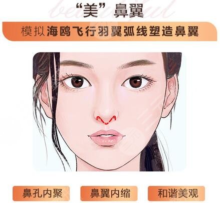 成都米兰柏羽做鼻子