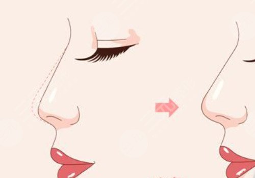 东莞东城华美医疗美容门诊部怎么样?