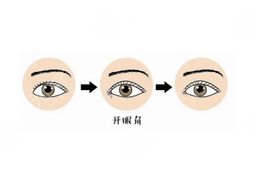 中山大学附属第三医院整形科怎么样?