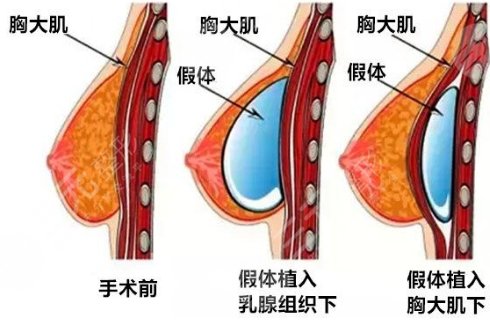 广西南宁东方医疗美容医院口碑咋样?