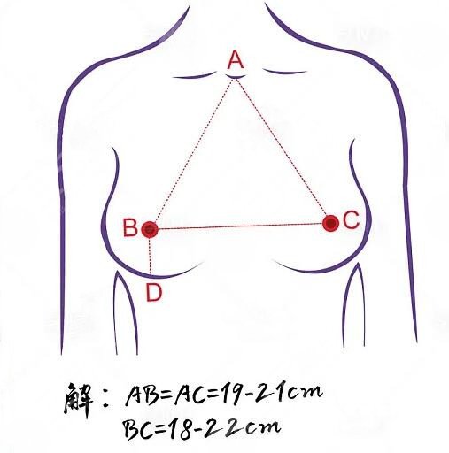 隆胸