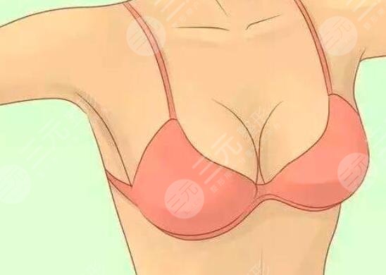 假体丰胸手术