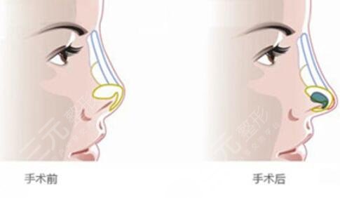 杭州整形医院热门项目