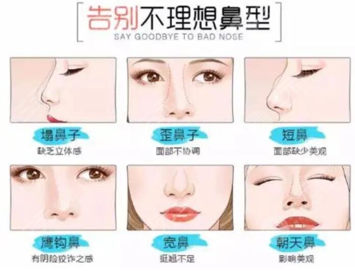 硅胶假体隆鼻手术