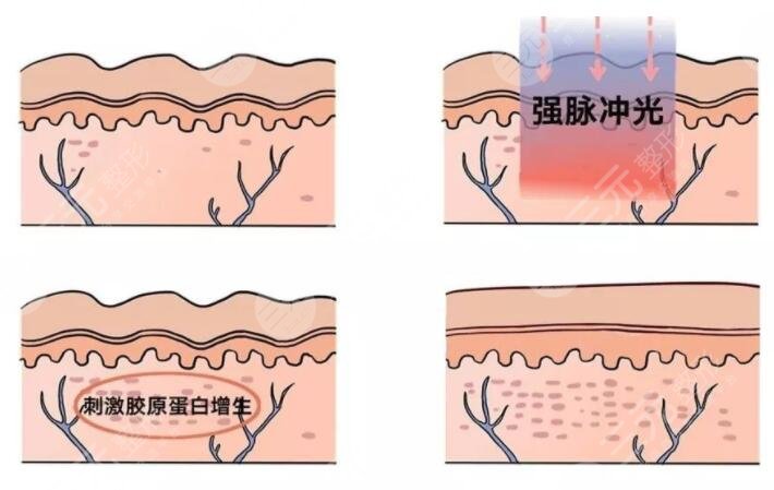 重庆西南医院整形美容专科医院热门项目