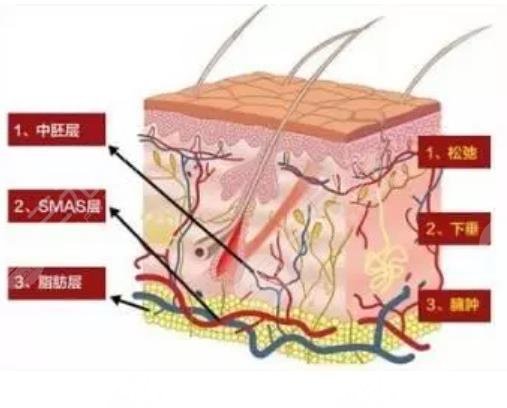 热玛吉