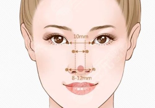成都米兰柏羽割双眼皮医生介绍