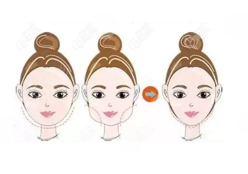 北京伊美尔医疗美容医院坐诊医生介绍