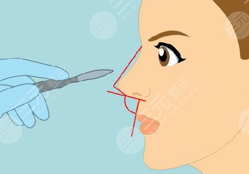 八大处整形医院怎么挂号