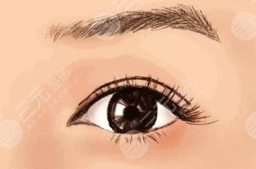 成都米兰柏羽割双眼皮医生介绍