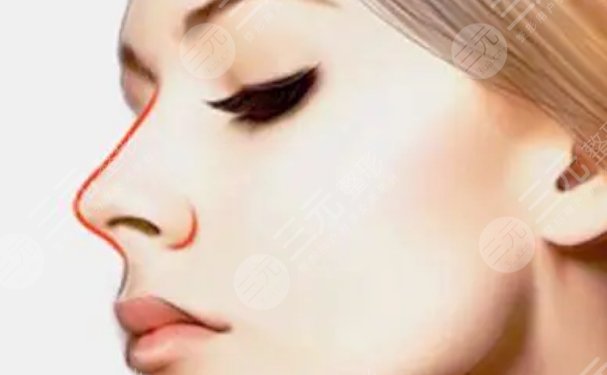 北京伊美尔医疗美容医院怎么样?