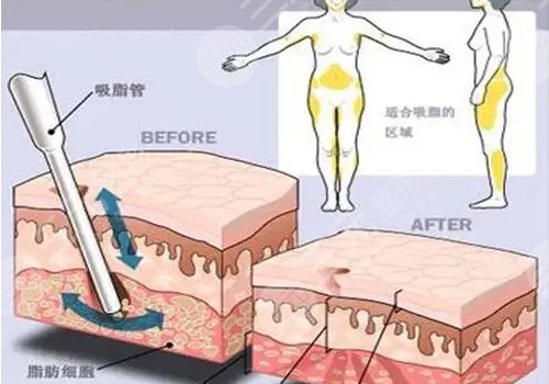 重庆军美医疗美容医院擅长项目