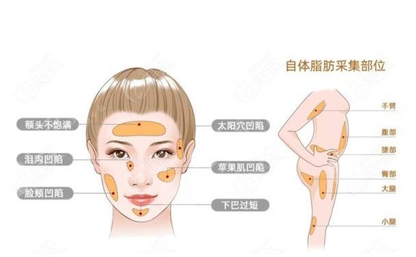 广州海峡医疗美容医院是正规嘛?