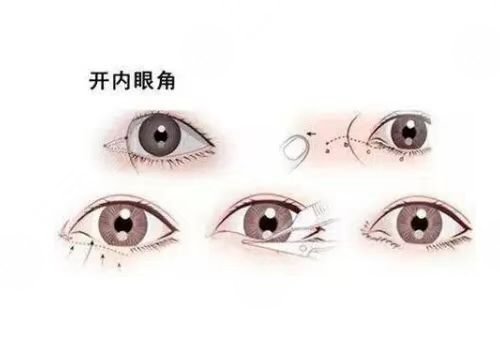 徐州医科汇美医疗美容正规吗?