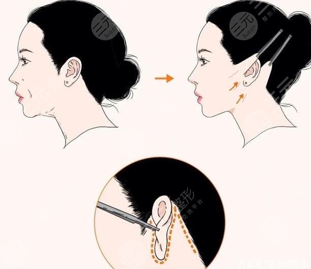 北京八大处整形医院热门项目